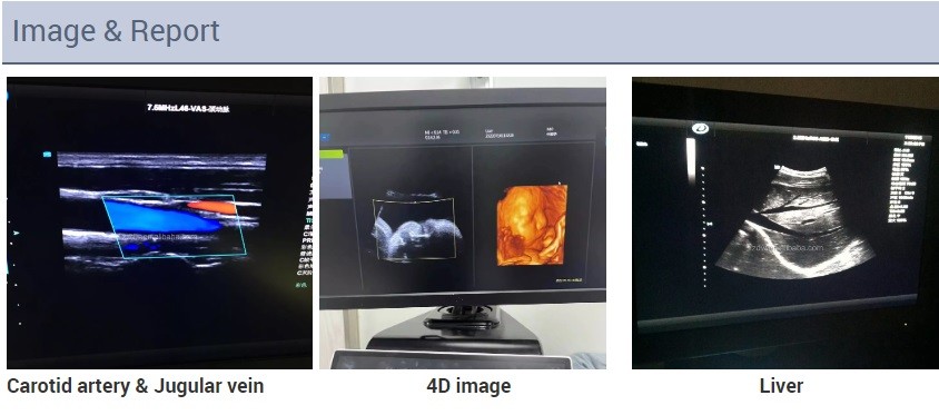 машина ультразвука Doppler цвета отголоска вагонетки 2D эхокардиографии 3D 4D сердечная