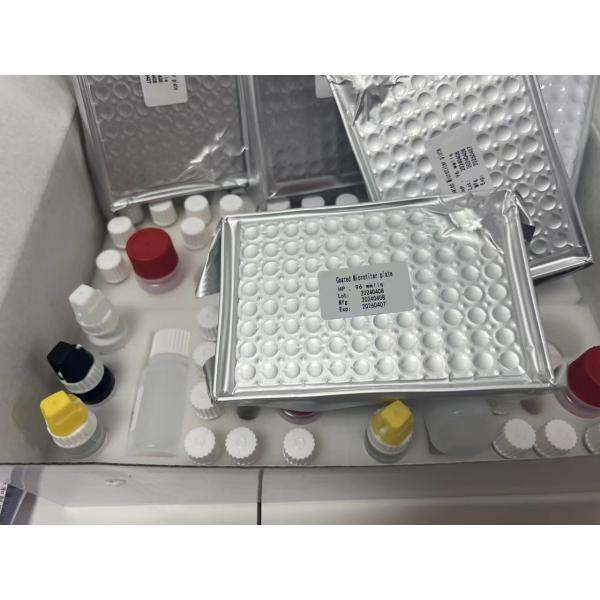High Sensitivity HBsAg ELISA Test Kit with 2-3 Hours Assay Time and 18 Months Shelf Life for Hepatitis B Detection