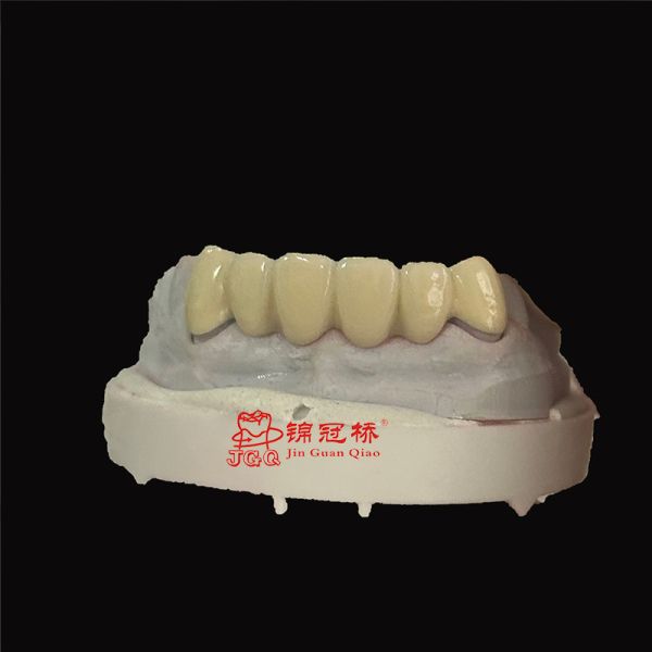Customized Pfm Titanium Teeth Durable Corrosion Resistant Ensuring Longevity