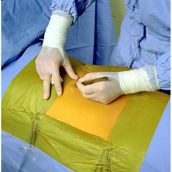 Ioban PU Surgical Incise Drape Antimicrobial Self Adhesive Wound Dressings