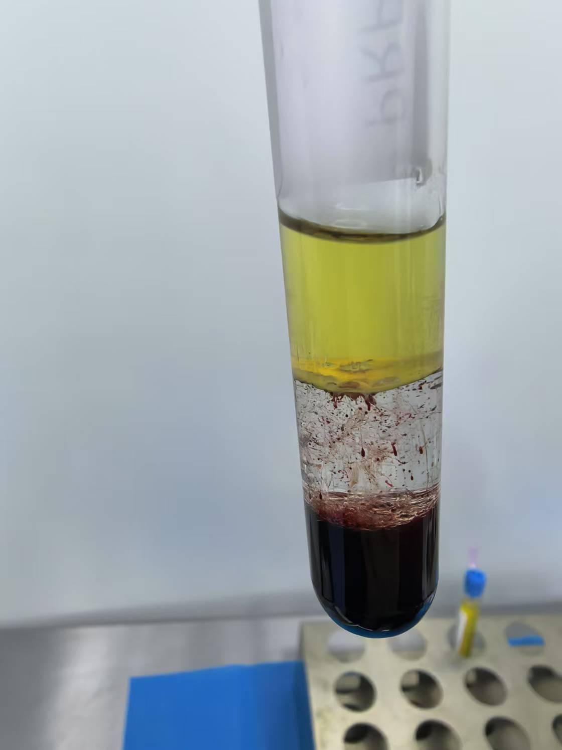 Low Red Blood Cell Residue PRP Tube Special Separation Gel for Platelet Separation