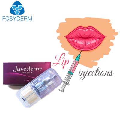 Juvederm Ultra 3 Hyaluronic Acid Dermal Filler For Face Lips