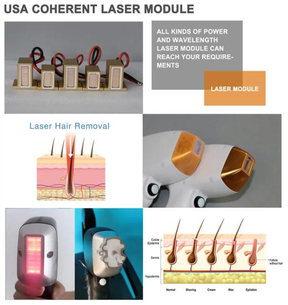 Professional Diode Laser Hair Removal Device - Smooth And Perfect Care For Your Skin