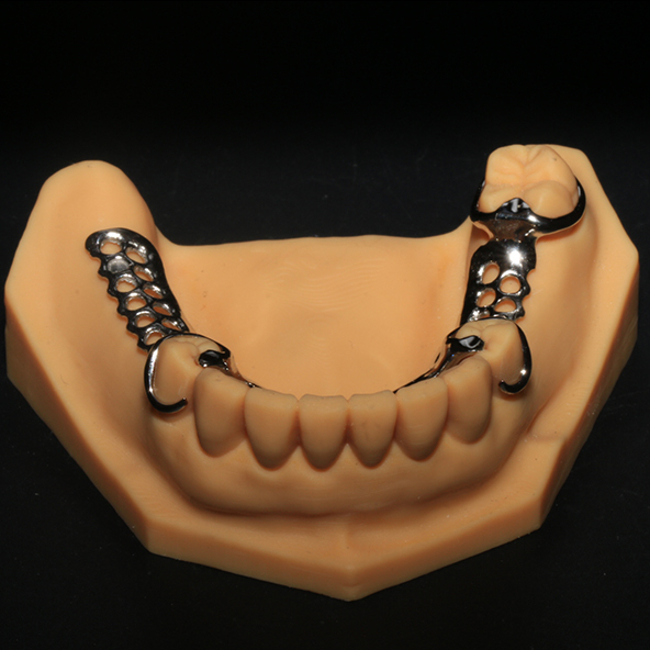 China Dental Lab Outsourcing  | High Strength 3D Printed Argen Dental Framework With Clear Clasps