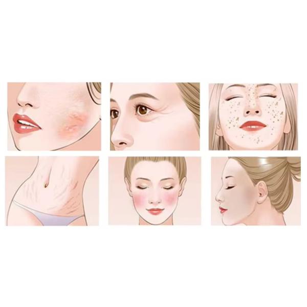 Dual Photodynamic Skin Whitening PDT LED Red Light Therapy  Machine