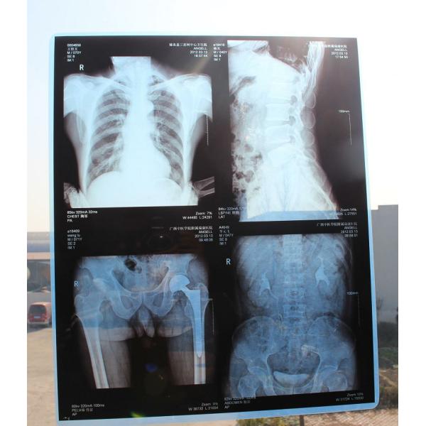 class I Medical Dry Thermal Sensitive Film for Inkjet Printer