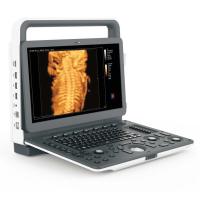 Portable 4D machine à ultrasons Interface de données médicales vidéo VGA DICOM3.0 Porte d'imprimante USB