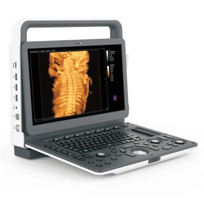 Portable 4D Ultrasound Machine Medical Data Interface Video VGA DICOM3.0 USB Printer Port