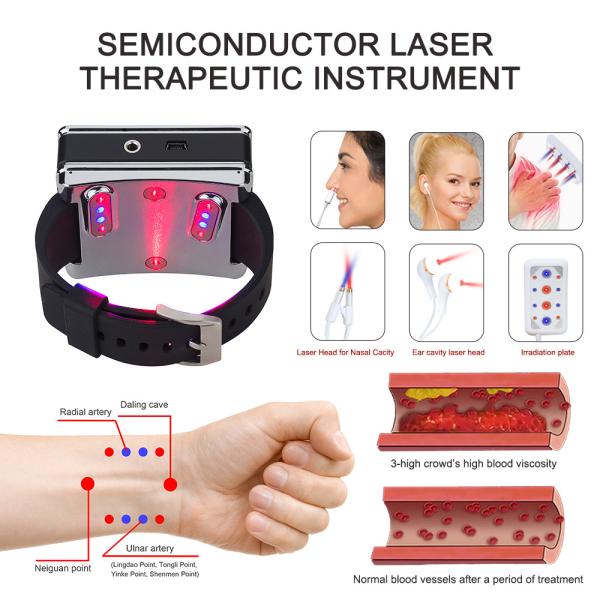 High Blood Pressure Laser Therapy Watch 650nm 450nm For Hypertension Management