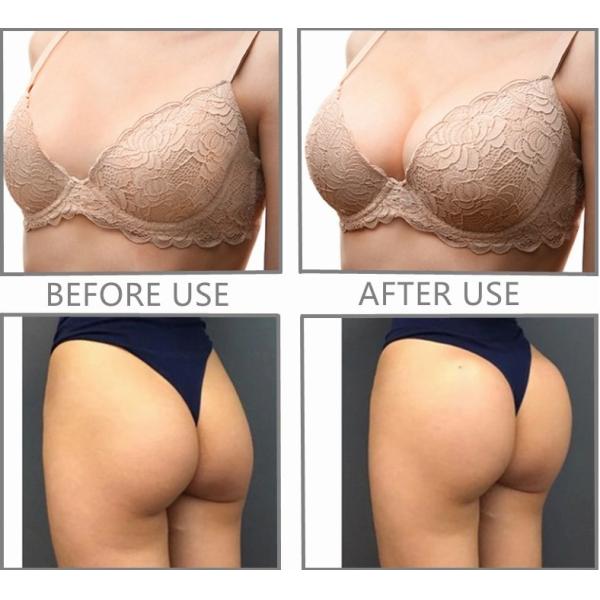 Батокс геля hialuronico Acido тазобедренный увеличивает дермальную впрыску увеличения батта насоса груди заполнителя большую