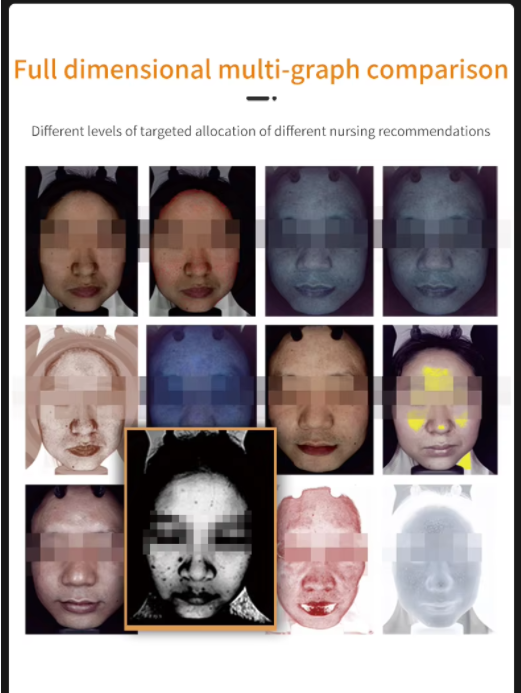 Smart 15.6 Inch 3D Digital New Generation AI Smart Facial Skin Analyzer Machine