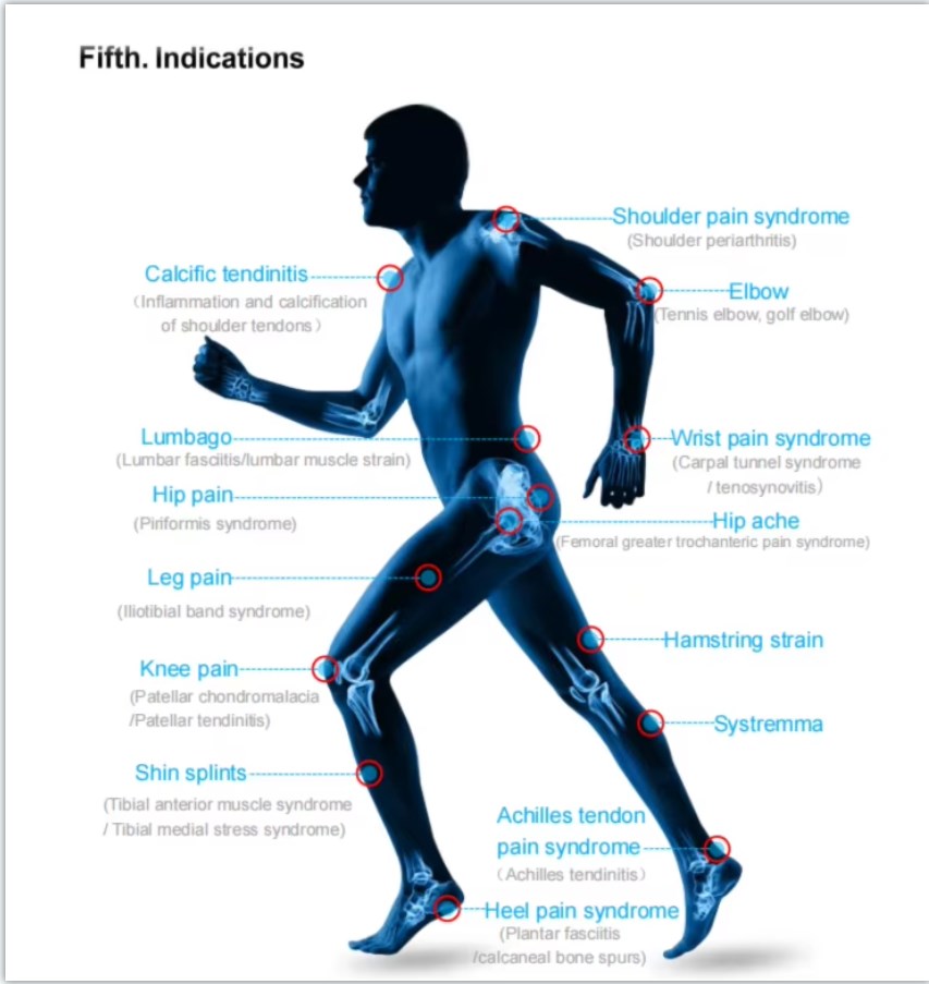 Focus Shockwave Focused Shock Wave Therapy Machine Regeneration Therapy Pain Relief Physio Equipment