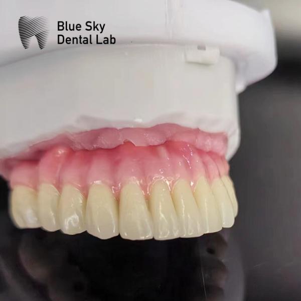 Nature Dental Implant Cases Smooth Full Mouth Implant Case For Implant System