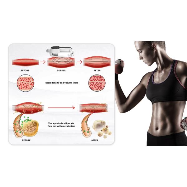 Профилировщик тела потери веса стимулятора мышцы Ems фабрики ваяя уменьшая машину