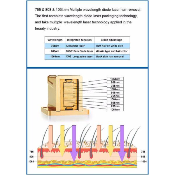 Diode Body Hair Removal 808nm 755nm 1064nm Laser Depilation Machine