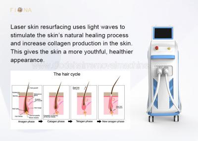 500 Thousand Shots Opt Shr Hair Removal Machine Multi Function Beauty Equipment