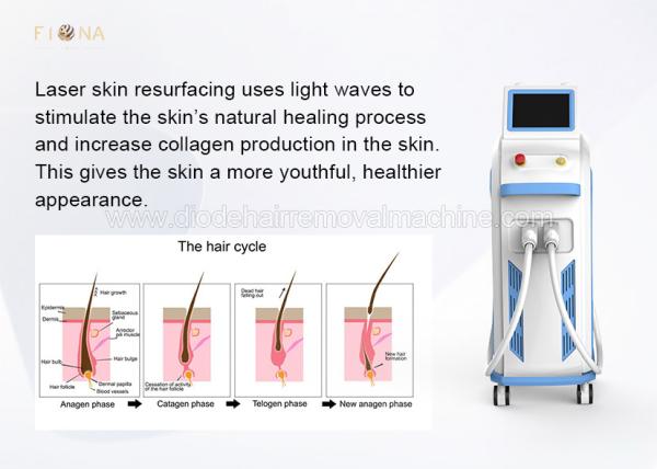 500 Thousand Shots Opt Shr Hair Removal Machine Multi Function Beauty Equipment