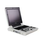 Portable Ultrasound Machine with Depth Display ≥250mm 8 TGC Control and Optional Battery 10Ah 14.4V