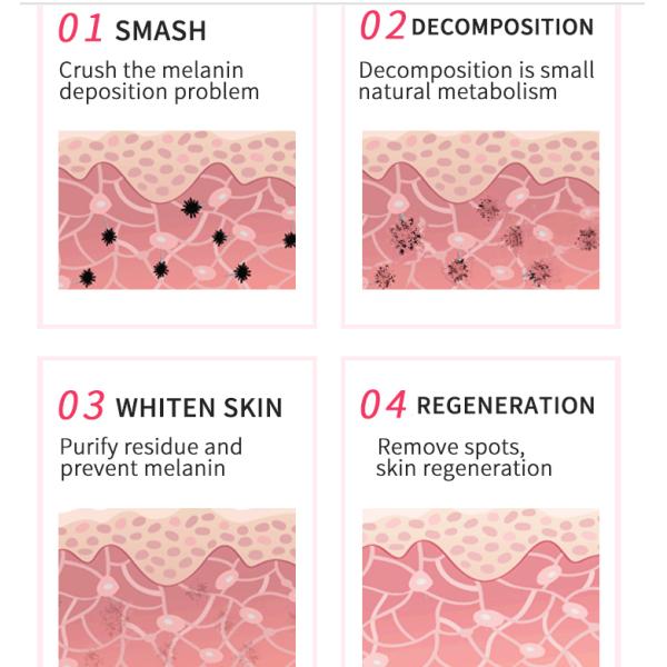 1064nm 532nm 1320nm Professional Laser Tattoo Removal Machine 500w Power