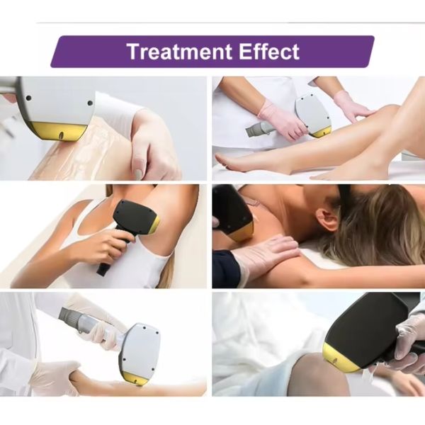 Commercial 2 In 1 Diode Laser Machine , ND YAG Aesthetic Laser Machine For Beauty Clinics