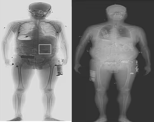 Advanced MMW Security Body Scanner Intelligent Millimeter Wave Scanners With Auto Recognition