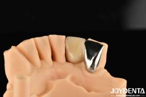 Dental Metal / Maryland Bridege Oral Clinical Repair Metallic Ideal Color