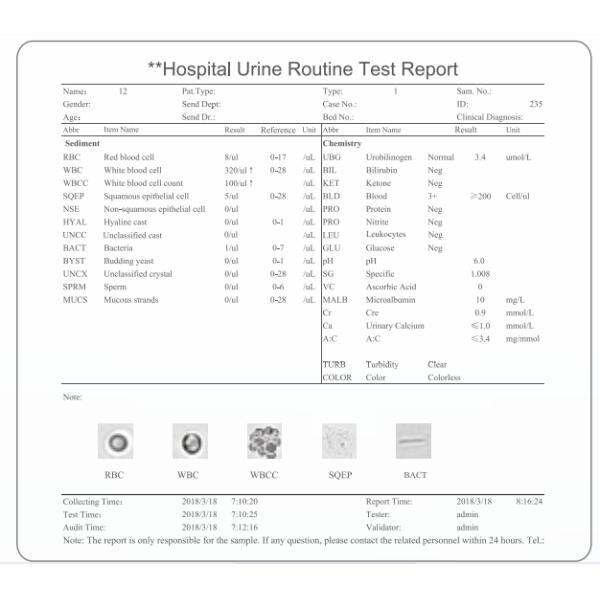 Fully Automated Urine Analyzer Machine 60 T/H Clinic Hospital Use