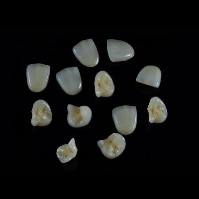 Dental Restorations IPS EMax Inlay Onlay All Porcelain Highly Durable
