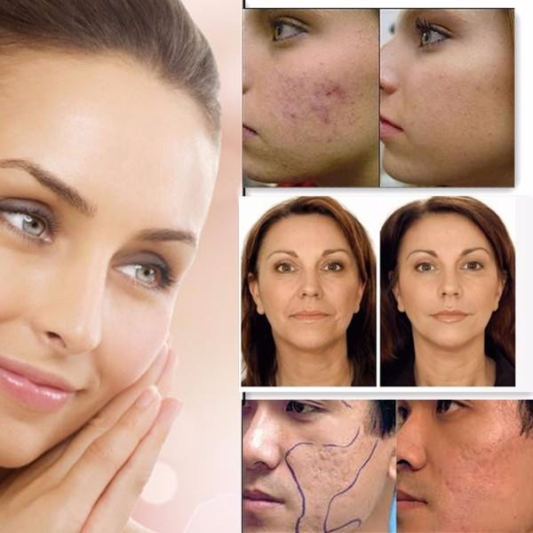 Salon Spa Use Led Red and Blue Light Therapy Heating Acne Infrared for Facial Treatment