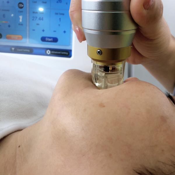 10,4 de” apertos fracionários da pele do levantamento de cara Microneedling RF