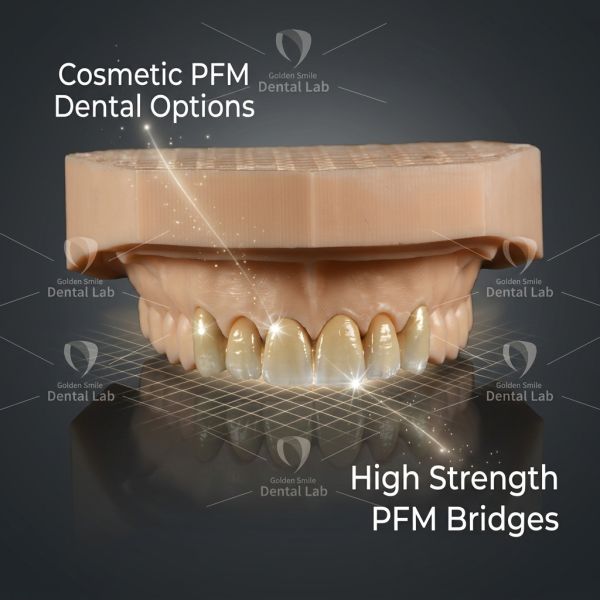 CDT MDT Digital Design Dental Lab Co-Cr PFM Bridge Chinese Dental Laboratory