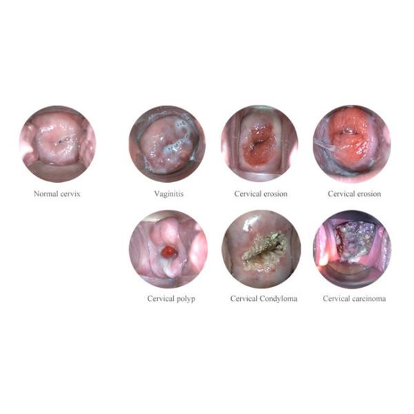 X Colposcope électronique de Digital de 1,5 rapports optiques se relient à la TV ou l'ordinateur ou le moniteur médical santé de s pour femmes '