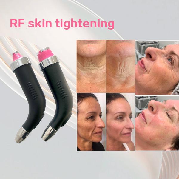 Épilation laser à diode portative 808nm Picosecond Machine d'épilation de tatouage