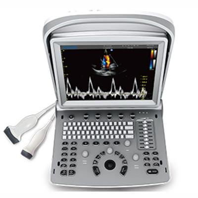 12 Inch LED Chison Portable Ultrasound Machine ECO6 With Long Battery Life