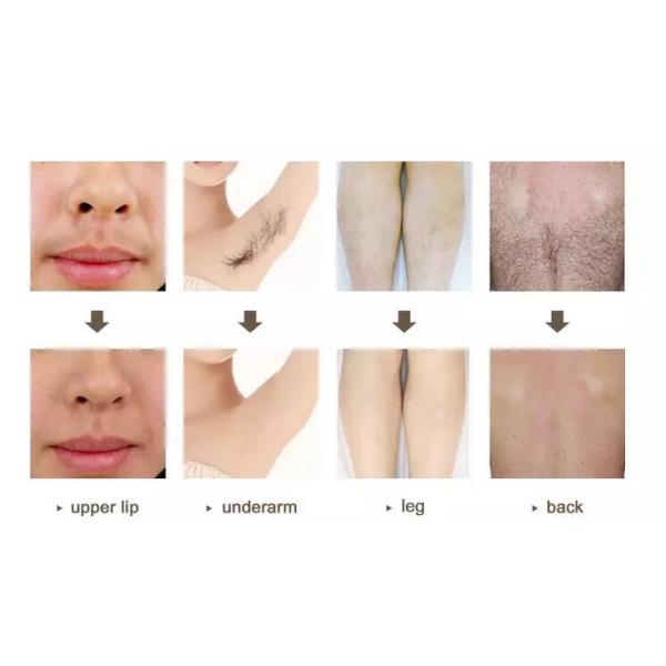 Multifunctional Portable OPT IPL SHR Laser Hair Removal Equipment 2 Colors Optional