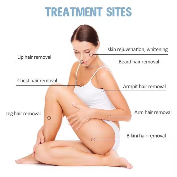 3 In 1 Soprano Sapphire 808 Diode Laser Hair Removal Device Ipl Laser Hair Removal