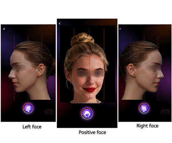 AI Facial Skin Analysis System With 9 Spectral Imaging Microscopic Detection