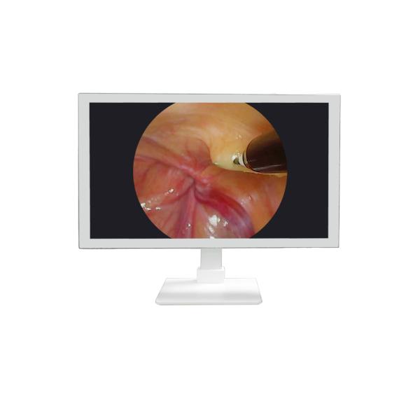 Equipo médico FHD 22 24 27 pulgadas Endoscopio Monitor de cámara Display Monitor médico Full HD