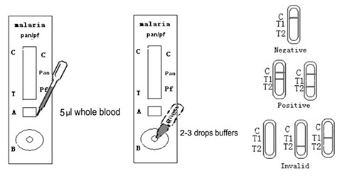 One Step Malaria pan/ pf Antigen Detection Test Device Whole Blood Colloidal Gold  Rapid Test