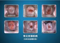 Appareil mobile électronique de Colposcope de Digital d'affichage élevé de définition pour vérifier le cervix et le Vagin