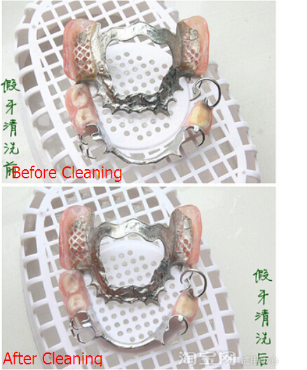 Стерилизация уборщика 0.8L 30W высокоскоростной нержавеющей стали ультразвуковая зубоврачебная