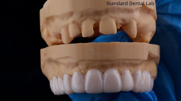 Appareils dentaires fonctionnels d' automne d' orthodontie du laboratoire dentaire chinois