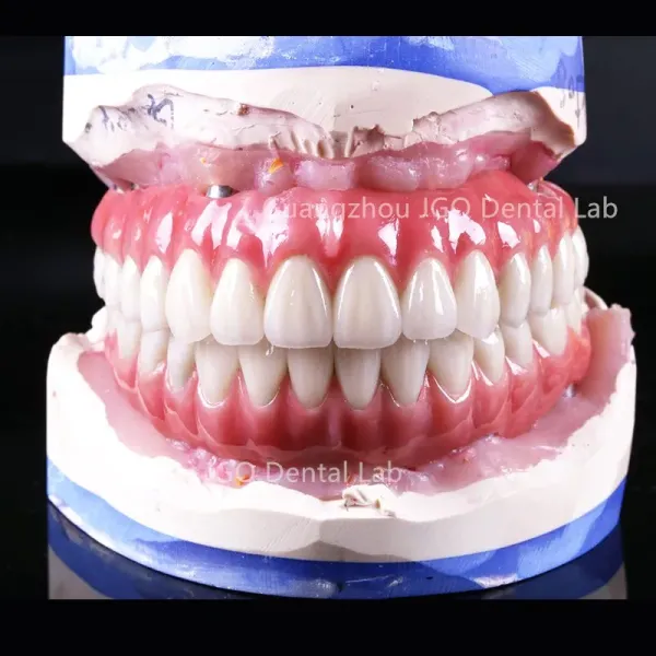 Permanent Restoration Full Contour Zirconia Crown Dental Implant with Custom Milled Titanium Frame