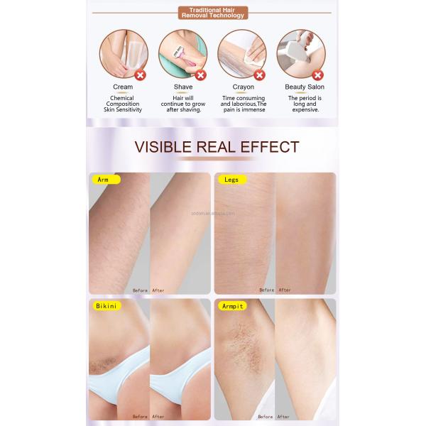 999900 Flashes IPL Hair Removal Device for Women Permanent Body Bikini Leg Arm Face