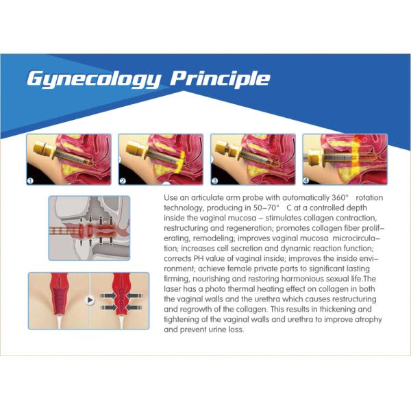 Big Discount Fractional CO2 Laser machine for Vaginal Tighten, Scar Wrinkles Removal Skin Resurfacing with 3 warranty