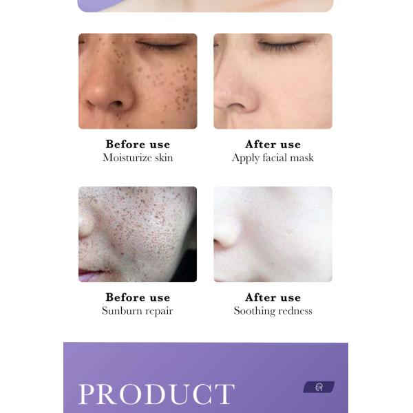 30ml OEM Skin Care Products Freckle Removal Nicotinamide Whitening Spot Removing Facial Mask