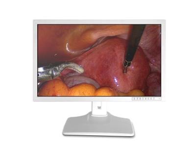Medical Endoscope Monitor Screen 32inch 3840 X 2160