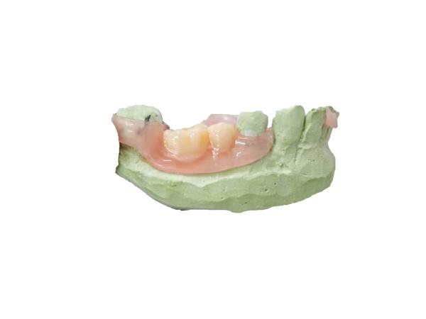 Flexible Resin or Hard Resin Elastic Resin Offers the Best Elasticity and Softness for Invisible Braces