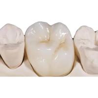 Alto densidade dental da coroa da zircônia branca da porcelana desobstruído