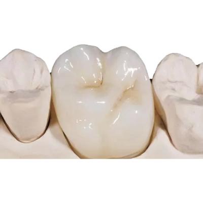 Alto densidade dental da coroa da zircônia branca da porcelana desobstruído